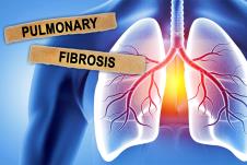 plućna fibroza, pluća