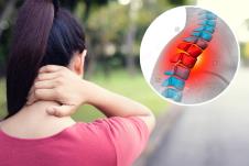 grba na vratu, vrat, kučma, bol u vratu.jpg