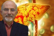 prof. dr Staniša Stojiljković/model masne jetre