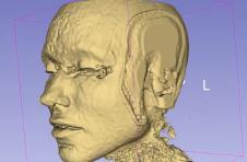 fileri, magnetna rezonanca