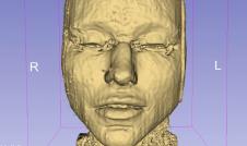 fileri, magnetna rezonanca