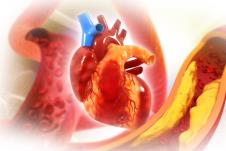 grafički prikaz srca i krvnih sudova sa holesterolom