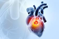 grafički prikaz raka srca