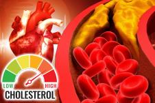 holesterol srce.jpg