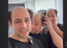 trojke, transplatacija kose