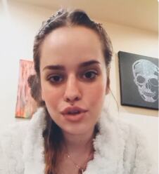 Natalija ispričala simptome šuge.