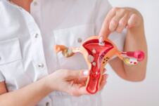 doktorka u beloj uniformi drži prikaz ženksim reproduktivnih organa sa polipima