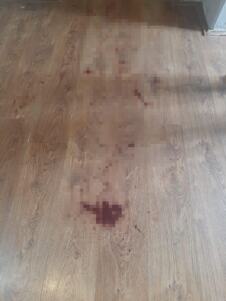 Šid maloletnica izbola mladića