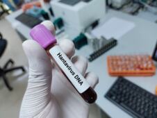 epruveta na kojoj piše hantavirus test