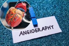 Angiografija.jpg