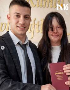 Berfin Ozek, udala se za bivšeg koji joj je bacio kiselinu u lice