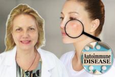 dr Mirjana Zlatković-Švenda/promene na koži usled autoimune bolesti