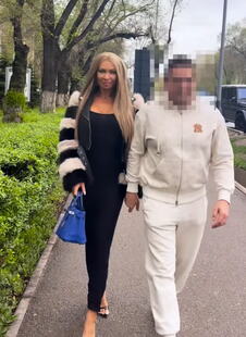 Milica Polskaja pokazala deku i slike pre operacija