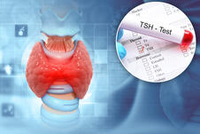 TSH , test