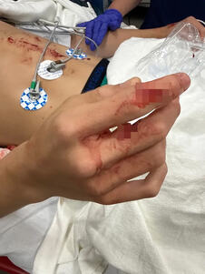 savage-attack-boy-13-brutally-1108803203.jpg