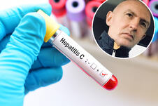 Hepatitis1.jpg