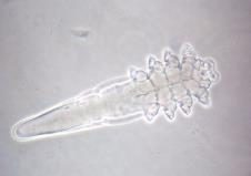 demodex-folliculorum.jpg