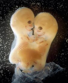 fetus-5.jpg