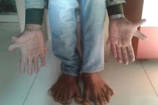 devendra-covek-7-prstiju.jpg
