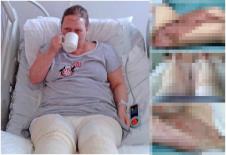infekcija.jpg