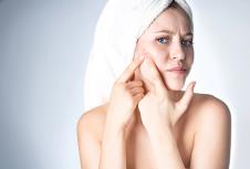 stockphotoawomanisunhappywiththeskinonherfaceyoungwomanintowelonhead776721322.jpg