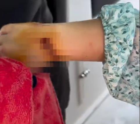 2025-04-18 12_06_53-Terrifying moment woman is savaged by a shark while snorkelling in the Maldives .png