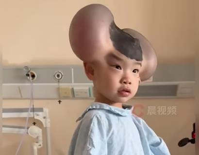 dečak Miki Maus 5.jpg