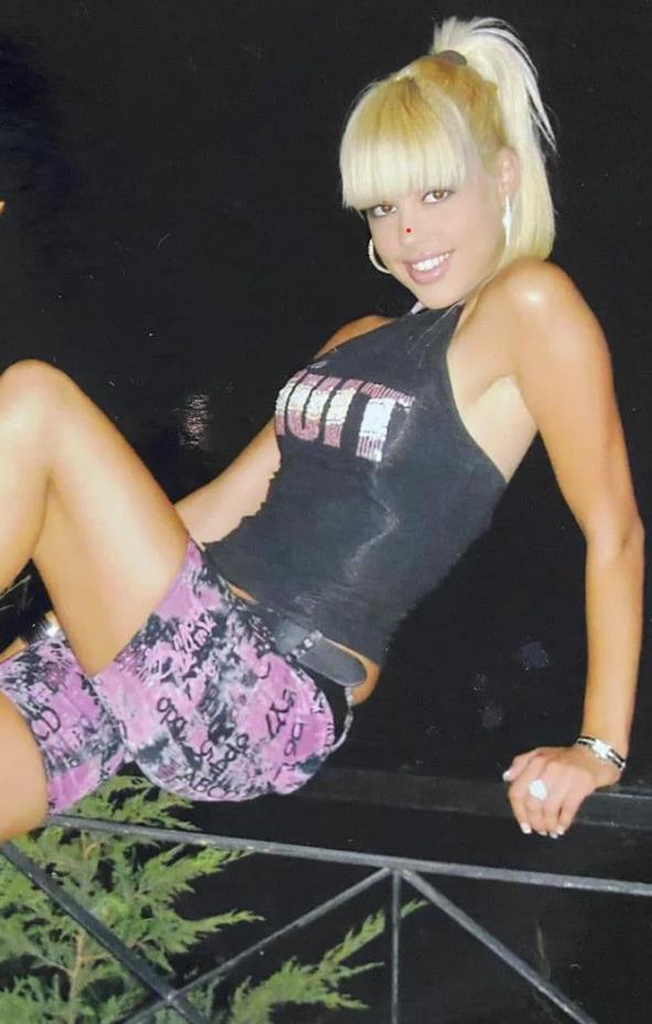 Dijana Diline pre operacija