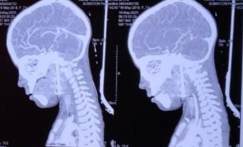 dečak ekser profimedia-1005204028.jpg