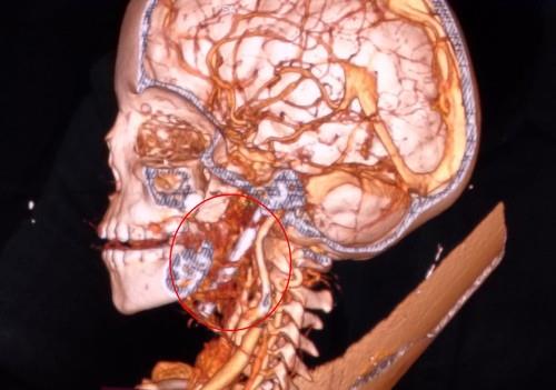 dečak ekser profimedia-1005203979.jpg