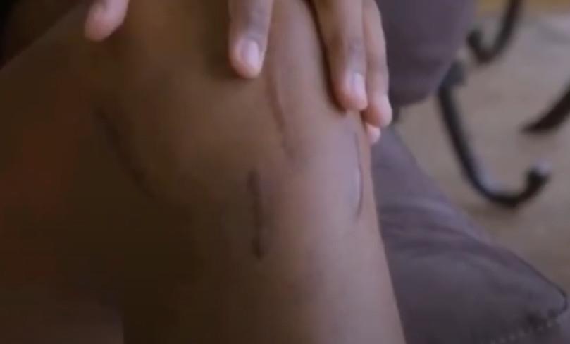 Džabari Parker koleno povreda