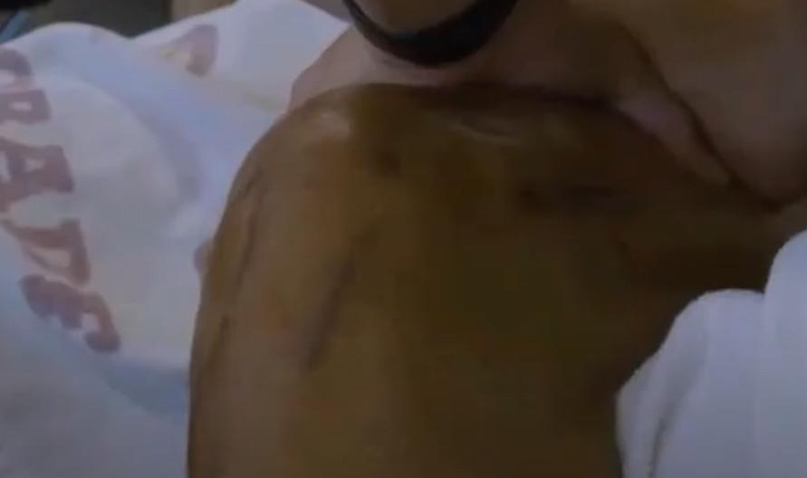 Džabari Parker koleno povreda