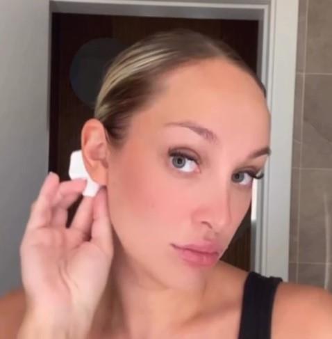 Luna Đogani lepi uši flasterom