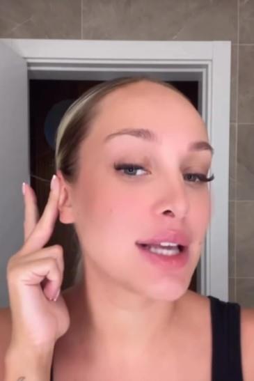 Luna Đogani lepi uši flasterom