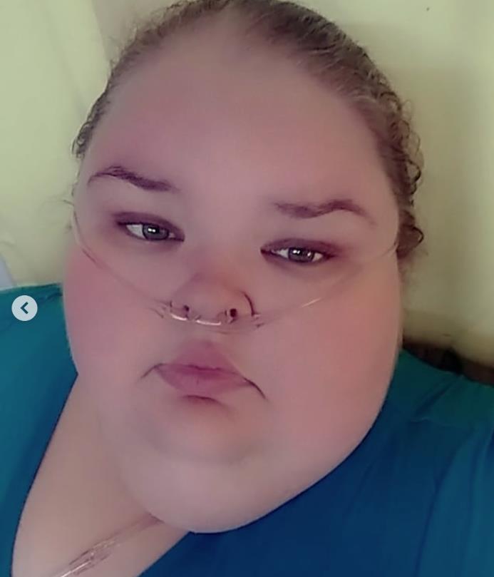 Temi Slejton smršala 226 kg.jpg