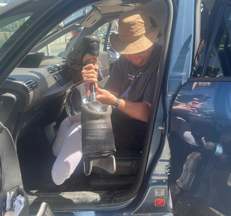 Vaskularni hirurg optužen da je sam sebi odsekao noge