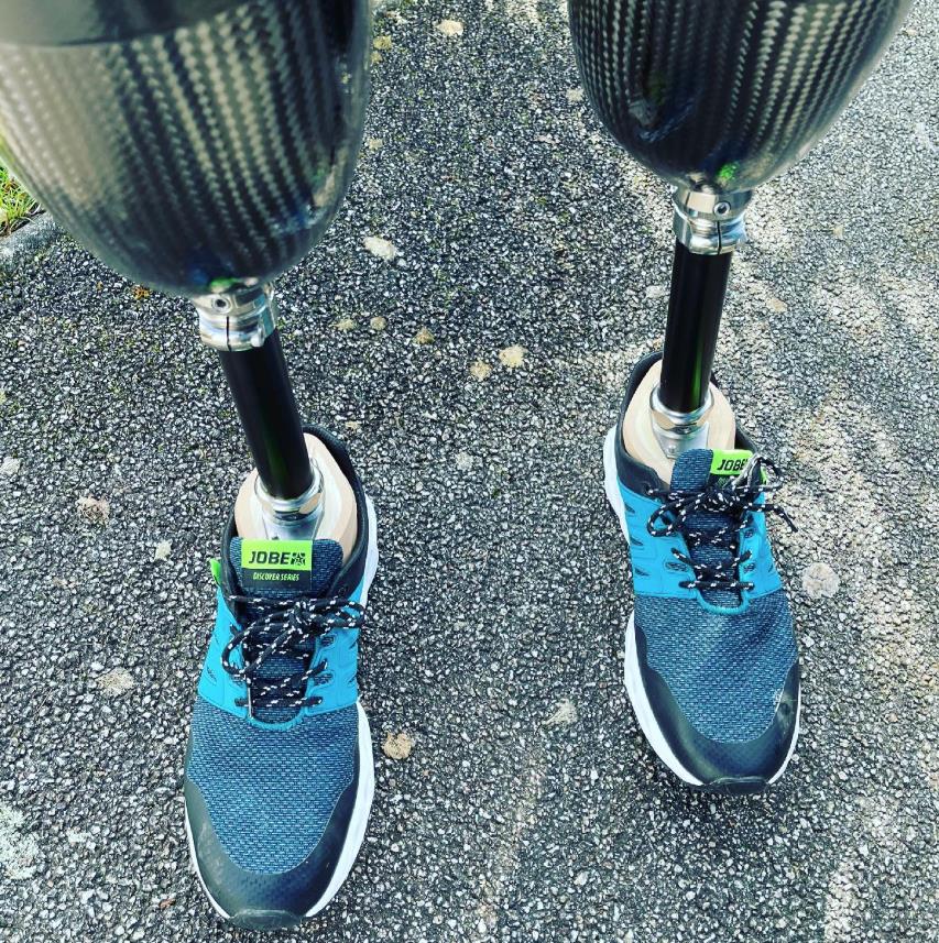 Vaskularni hirurg optužen da je sam sebi odsekao noge