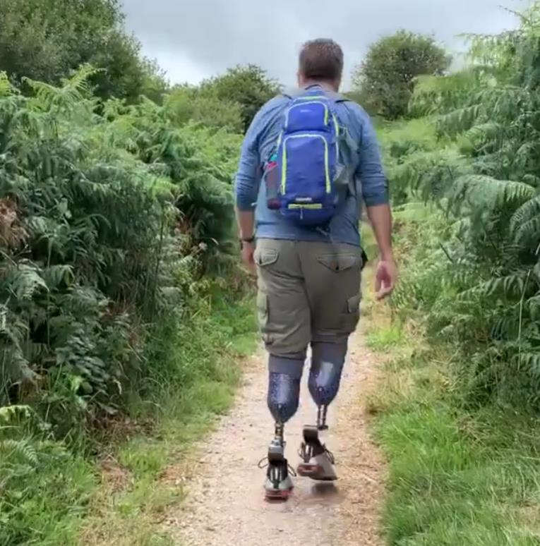 Vaskularni hirurg optužen da je sam sebi odsekao noge