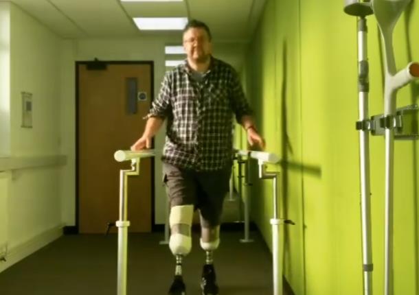 Vaskularni hirurg optužen da je sam sebi odsekao noge