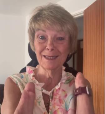 Kim Smit amputirali sve udove zbog urinarne infekcije.jpg