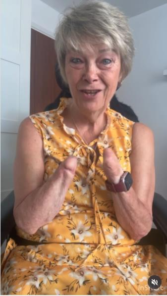 Kim Smit amputirali sve udove zbog urinarne infekcije.jpg