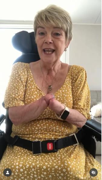 Kim Smit amputirali sve udove zbog urinarne infekcije.jpg