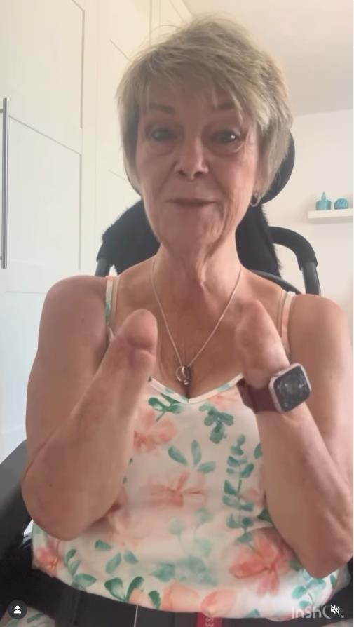 Kim Smit amputirali sve udove zbog urinarne infekcije.jpg