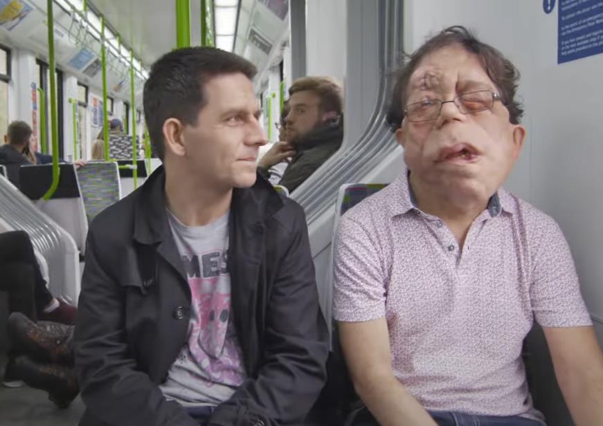 Adam i Neil Pearson danas