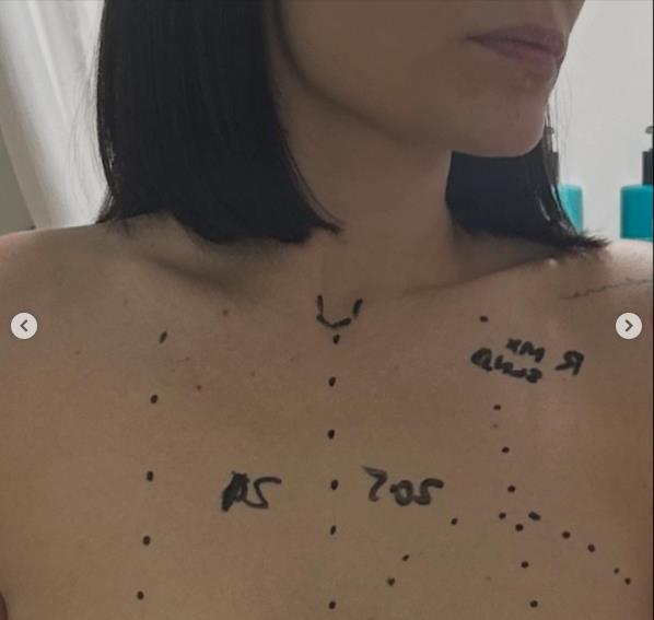 Džesi Džej otvoreno priča o svojoj borbi s rakom dojke