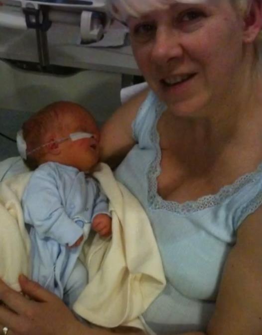 Noa Vol rođen sa 2% mozga