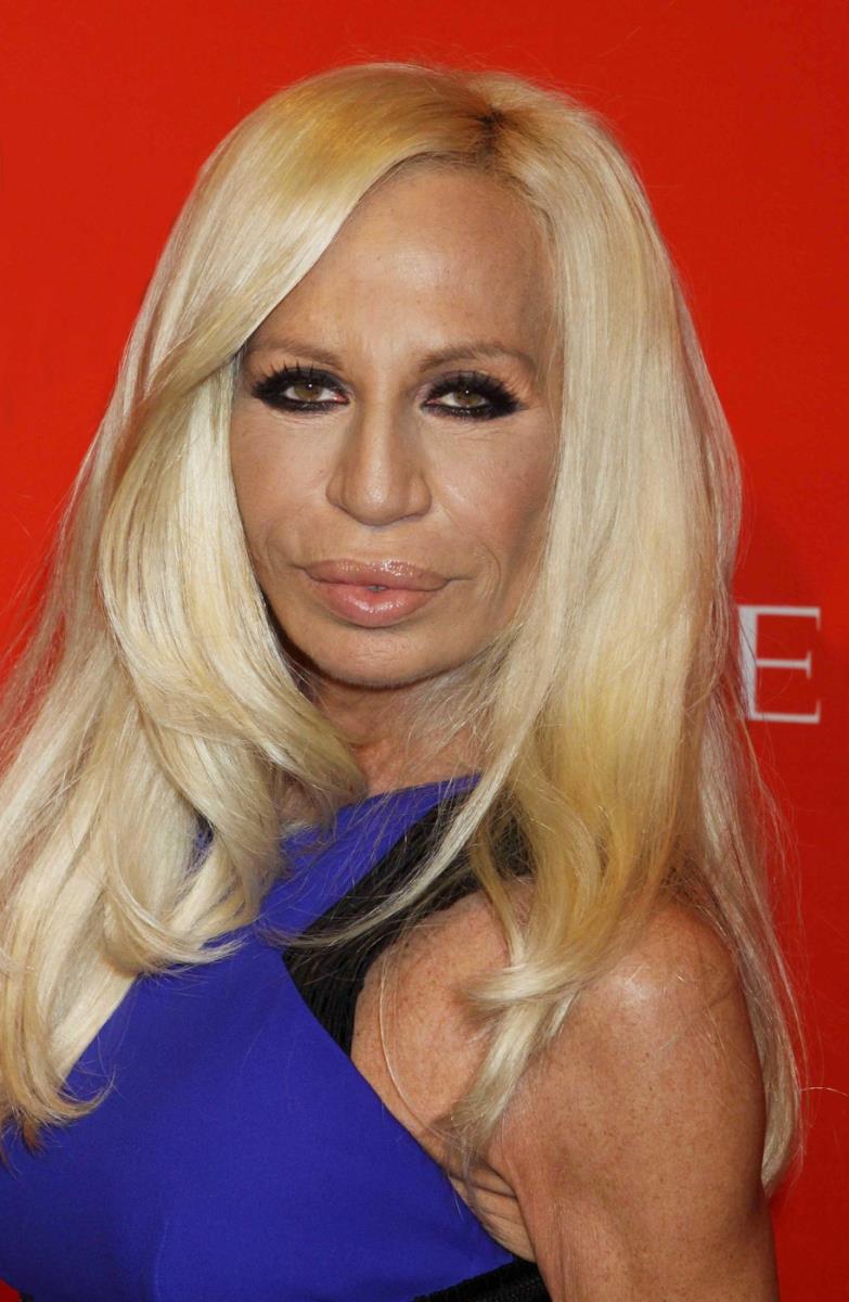 Donatela Versaće estetske operacije