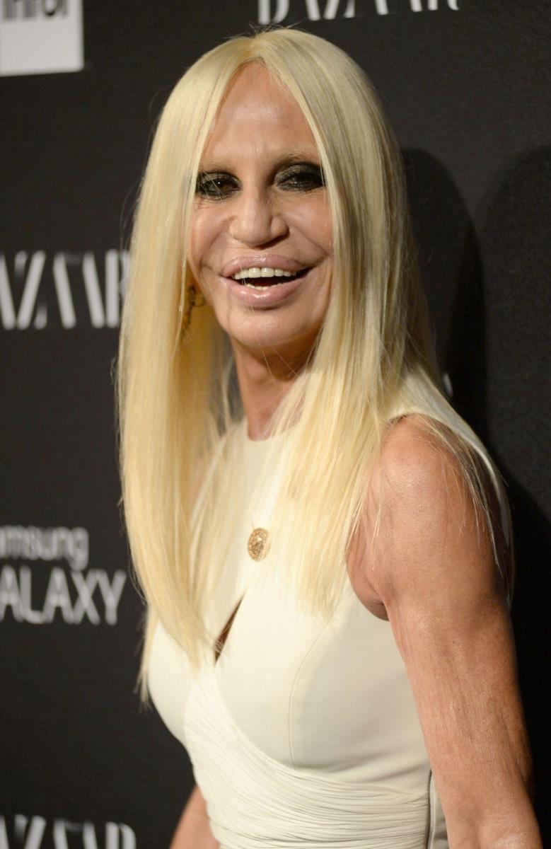 Donatela Versaće estetske operacije