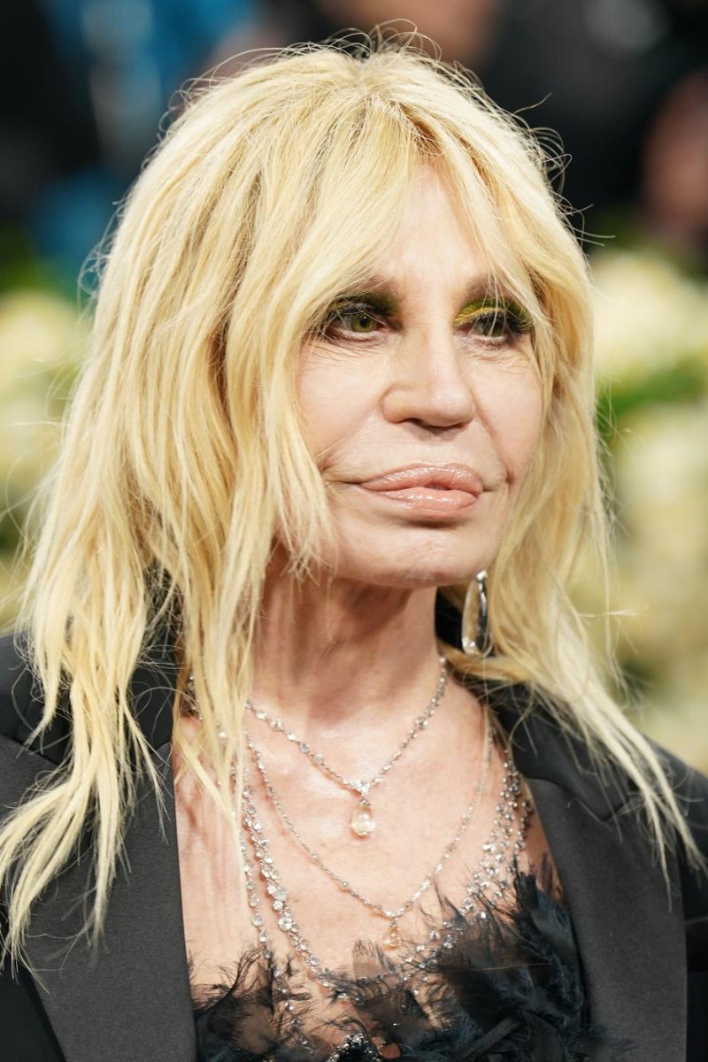 Donatela Versaće estetske operacije