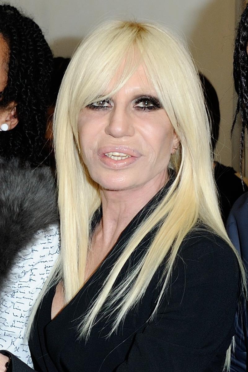 Donatela Versaće estetske operacije